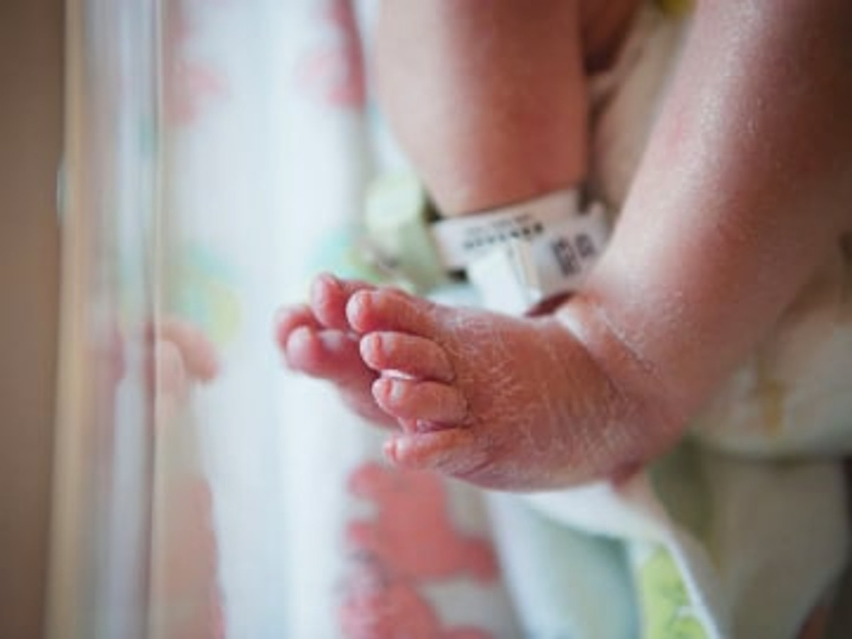 Eccema en bebés y niños pequeños